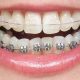 1 2 80x80 - تفاوت ارتودنتیست با دندانپزشک عمومی