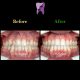 photo ۲۰۱۹ ۱۱ ۳۰ ۰۶ ۲۹ ۲۶ 80x80 - درمان ارتودنسي برای انحراف میدلاین دندان هاي فك بالا
