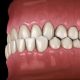 5 80x80 - اهمیت استفاده از نخ دندان در ارتودنسی