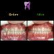 photo 2020 03 28 13 32 34 80x80 - درمان ارتودنسي نارضایتی از موقعیت دندان ها و فک پایین