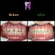 photo 2020 04 04 14 50 24 80x80 - درمان ارتودنسي نارضایتی از بی نظمی دندان