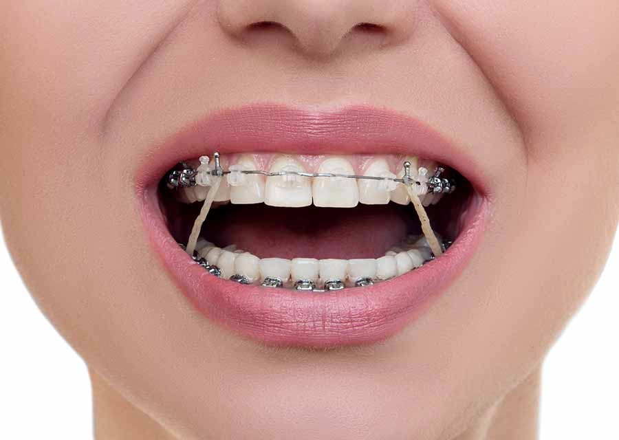 دندانپزشکی زیبایی و ارتودنسی