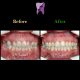WhatsApp Image 2020 06 21 at 14.46.39 1 80x80 - درمان ارتودنسی بی نظمی دندان های فک پایین