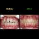 WhatsApp Image 2020 10 04 at 15.45.56 80x80 - درمان ارتودنسی ثابت در بیماری با سابقه ضربه به دندان های جلو