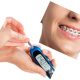 7 1 80x80 - درمان خشکی دهان در طی درمان ارتودنسی