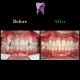 WhatsApp Image 2021 02 15 at 14.40.40 80x80 - درمان ارتودنسی ثابت در بیماری با سابقه ضربه به دندان های جلو