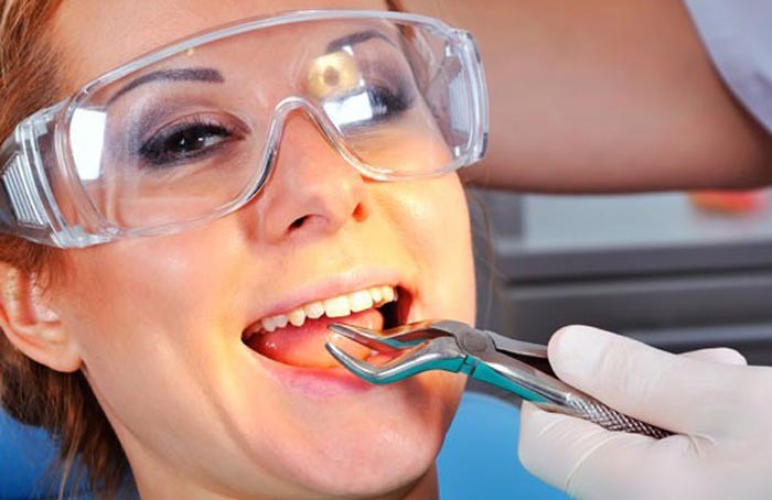 کشیدن دندان در طول ارتودنسی