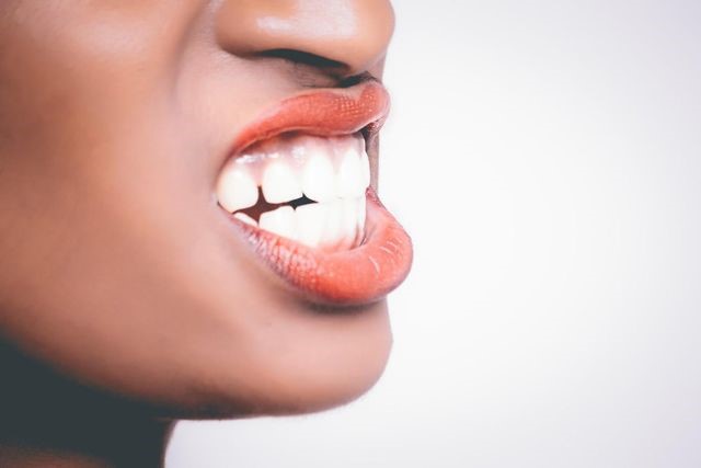7 - درمان دندان قروچه با ارتودنسی
