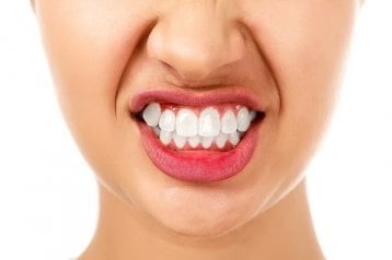 6 - دندان قروچه یا براکسیسم چیست؟