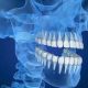 20 80x80 - آنچه باید درباره رادیوگرافی دندانپزشکی با اشعه ایکس بدانید!
