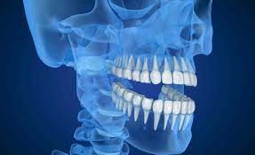 20 - آنچه باید درباره رادیوگرافی دندانپزشکی با اشعه ایکس بدانید!
