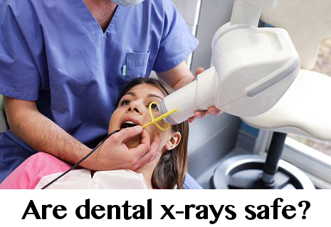 رادیوگرافی دندانپزشکی با اشعه ایکس