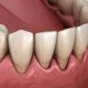 12 1 80x80 - راه هایی برای کاهش ترس از دندانپزشکی و درمان ارتودنسی