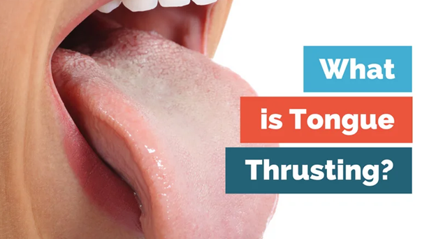 21 - تانگ تراست یا فشار دادن زبان به پشت دندان ها