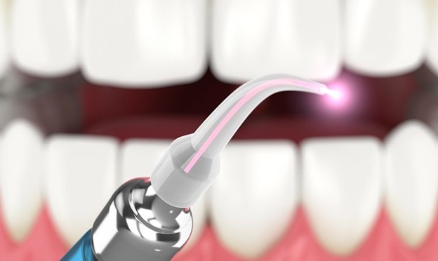 1 1 - کاربردهای لیزرهای دندانپزشکی در درمان ارتودنسی