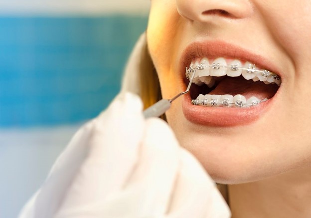 11 - فشردگی دندان ها و کمک ارتودنسی به درمان آن