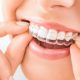 0 min 80x80 - چرا پاکسازی دندان توسط دندانپزشک ممکن است درد داشته باشد؟