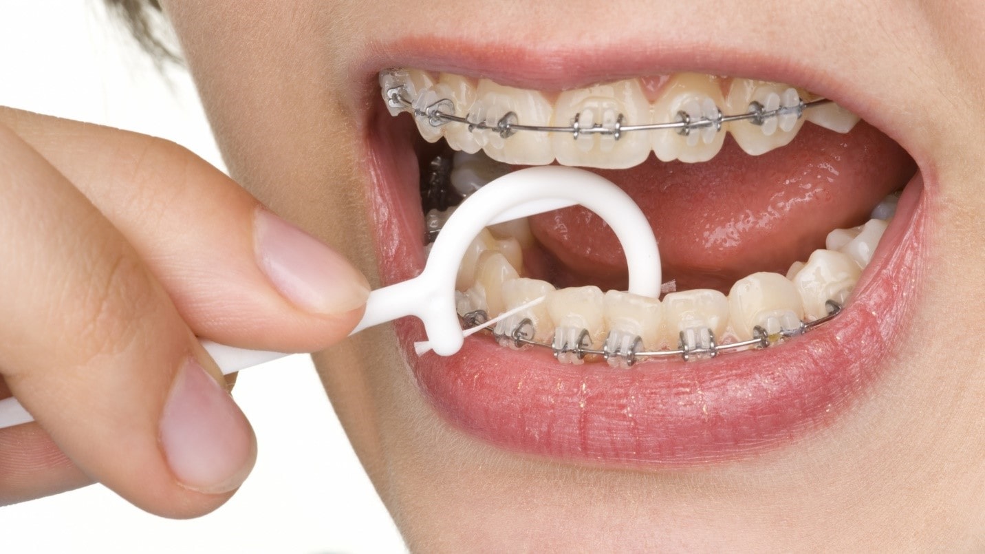 مراقبت های تخصصی از دندان ها