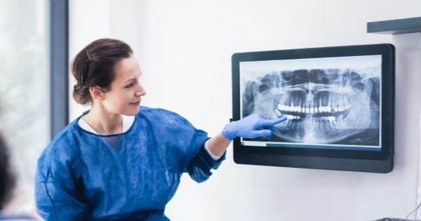 تحلیل رفتن استخوان در دندان چیست؟