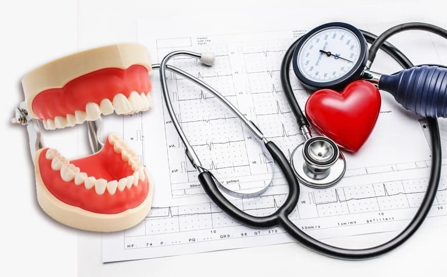 کنترل فشار خون و سلامت دندان