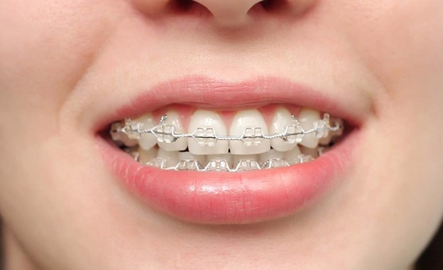 پاور چین چیست و چگونه کار می کند؟