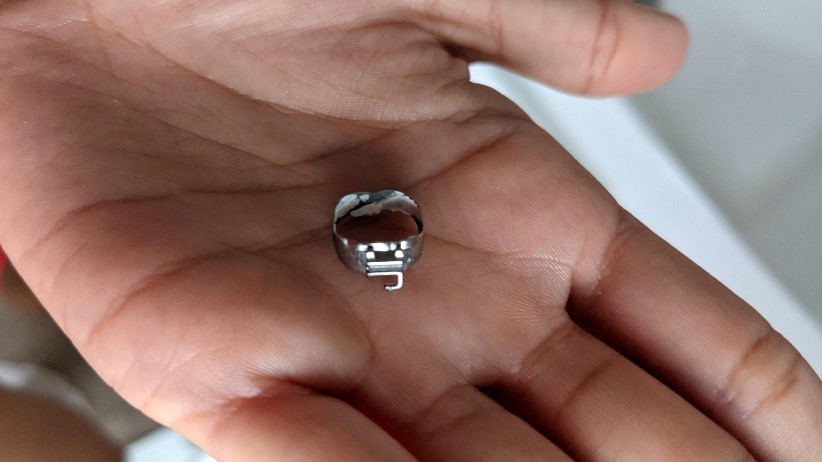 اگر احساس شل شدن بند دندان مولر می کنید چه باید بکنید؟