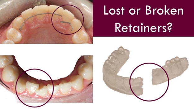 در صورت گم شدن یا شکستن ریتینر چکار باید کرد؟ در صورت گم شدن یا شکستن ریتینر چکار باید کرد؟