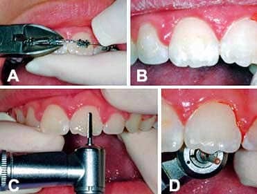 اشتباهات رایجی که باید از آنها اجتناب کرد